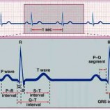 تشخیص آریتمی قلبی با استفاده سیگنال ECG و طبقه بندی آن با KNN